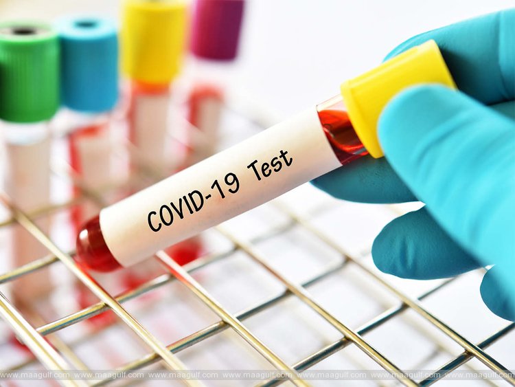 తెలంగాణలో కరోనా కేసుల వివరాలు